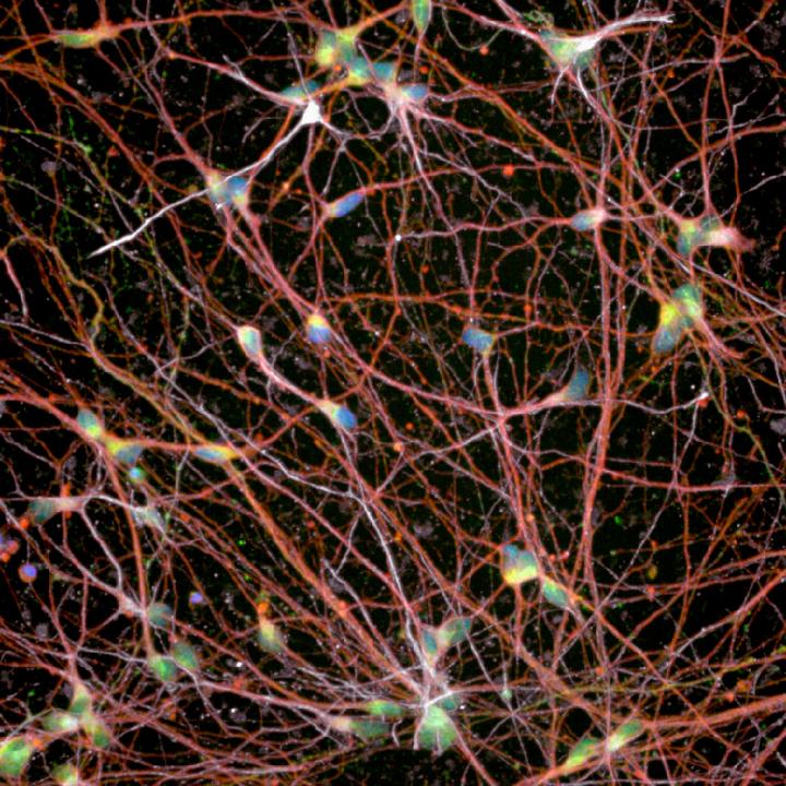 Human Stem-Cell-Derived Spinal Motor Neurons