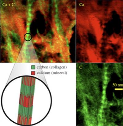 Orthopedics, Engineering Blend to Better Repair Torn Rotator Cuffs
