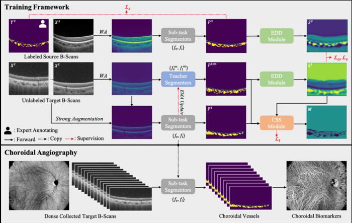 The structure of the novel deep learning based choroidal angiography