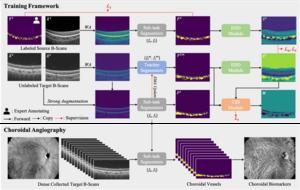 The structure of the novel deep learning based choroidal angiography