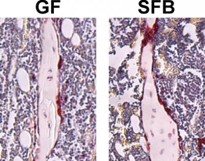 Mice with SFB Monoassocation Have An Increase in Osteoclasts