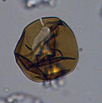 Dinoflagellate Cyst