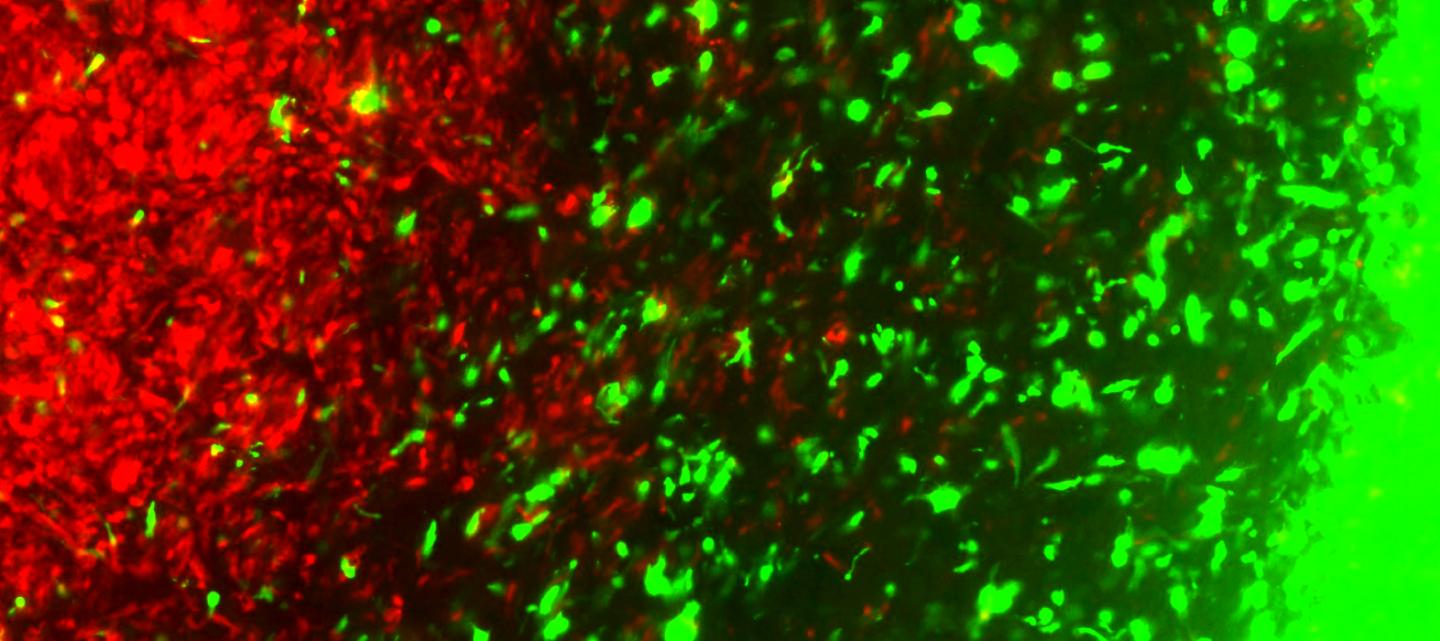 CRISPR Engineered Therapeutic Cancer Cells Tracking Primary Cancer Cells in the Brain