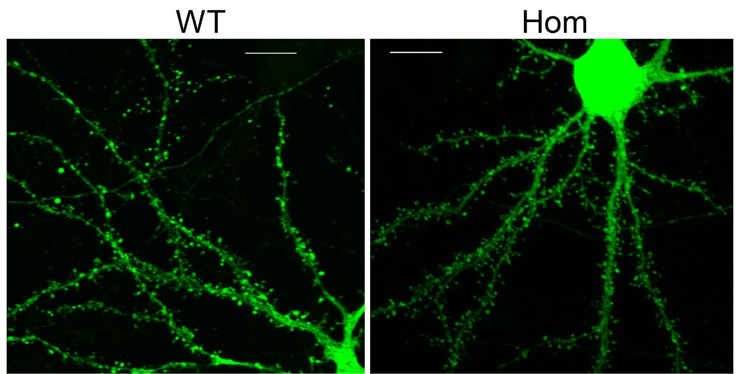 Two Studies Identify a Potential Risk Factor in Neurodevelopmental Disorders (1 of 1)