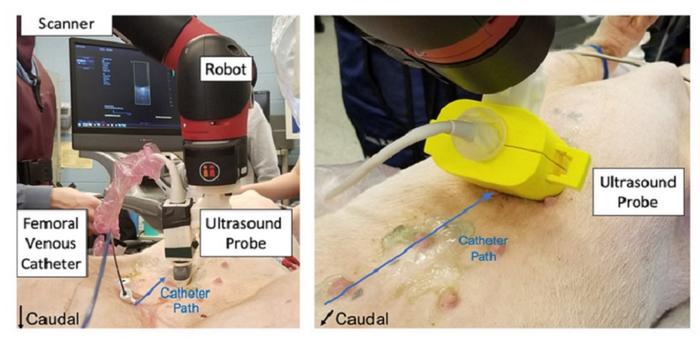 A photoacoustic approach to guiding cardiac catheters involves short laser pulses delivered using an optical fiber attached to a catheter, while a special signal transducer picks up the ensuing ultrasound waves generated within the heart.