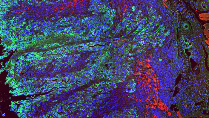 multi-color image of colon tissue