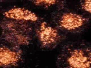 Gold Nanoparticles Stop Cancer from Reproducing