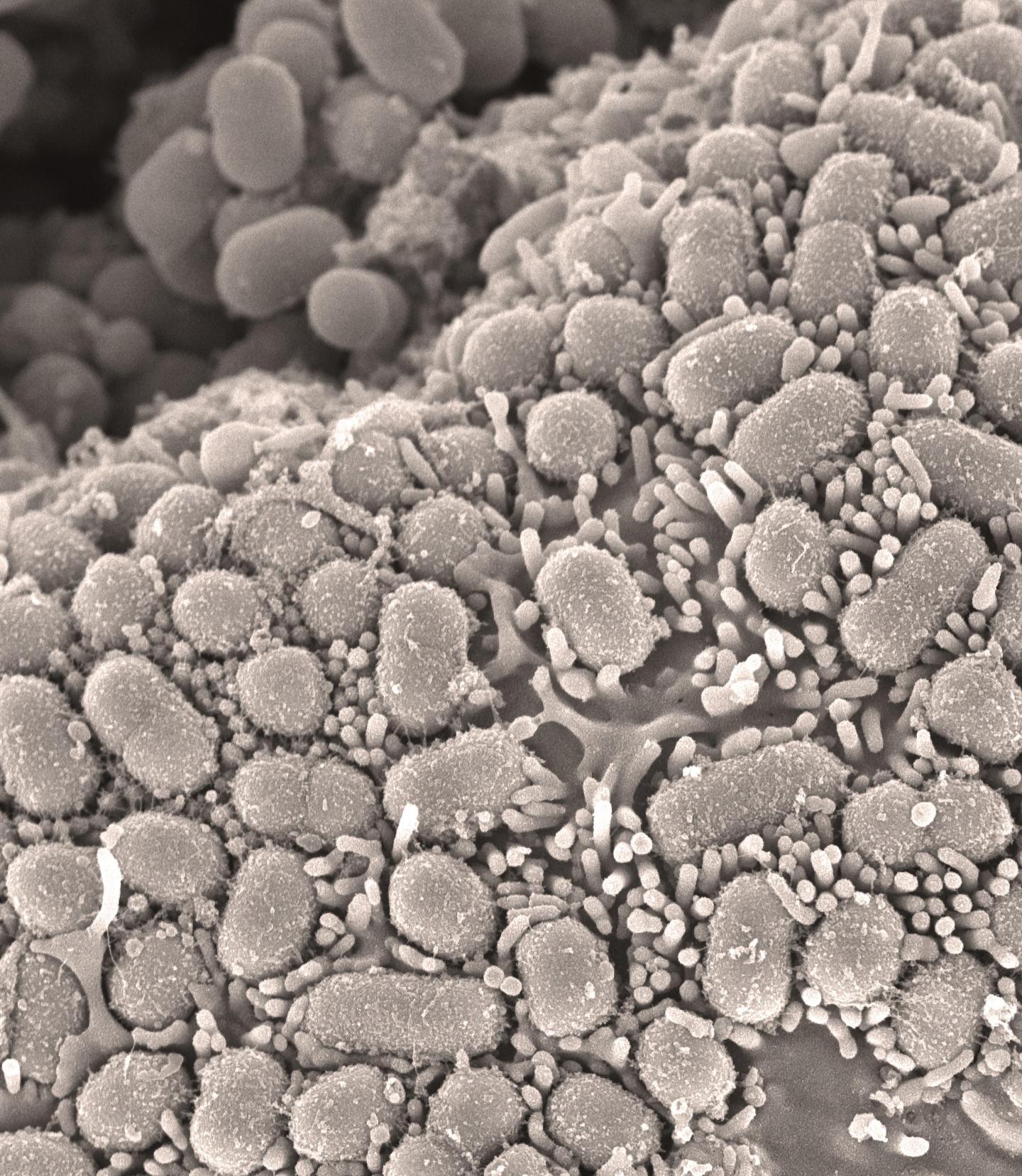 Scanning Electron Micrograph of Mouse Intestine Infected with Staphylococcus Aureus