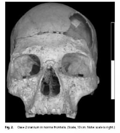 Oase 2 Cranium in Norma Frontalis