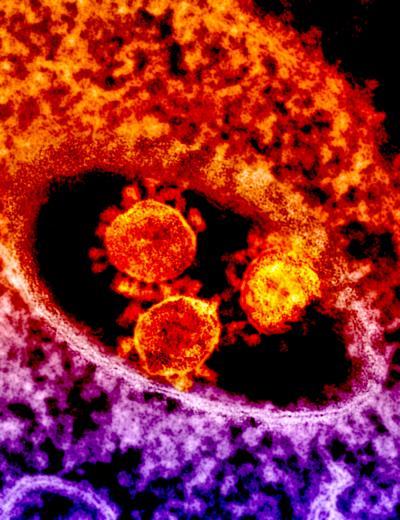 MERS Coronavirus Particles