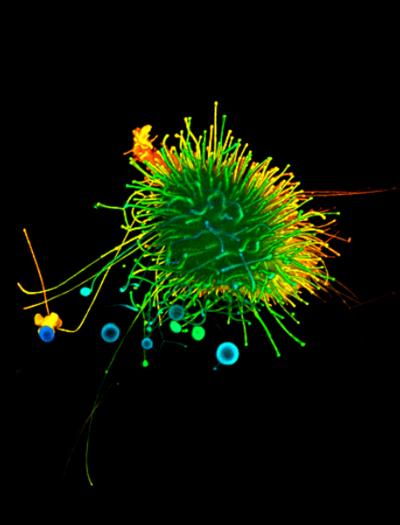 Cell Sugar Concentrations Affect Hyaluronan Production and Cancer Growth
