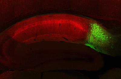 Studying CA1 and Subiculum Neurons