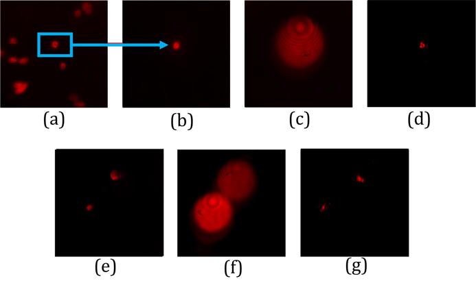 Manipulating Cell Networks with Light -- New Frontiers in Optical Microscopy (3)