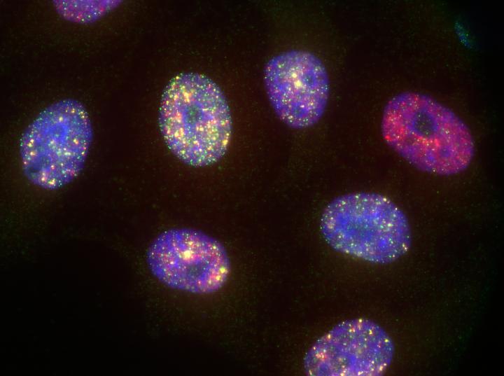 Hap1 Cells Stained for Different DNA Damages