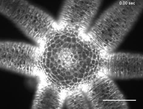 <em>Hydra vulgaris</em> Opening its Mouth (1 of 2)