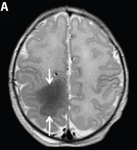 A Portable Bedside Brain Scanner for Babies (3 of 6)