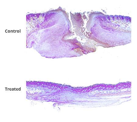 Wound Healing Comparison