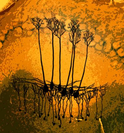 Computer Enhanced Image of Mitral Cells over a Background of Olfactory Bulb Cells