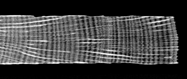 High- and low- density Bands