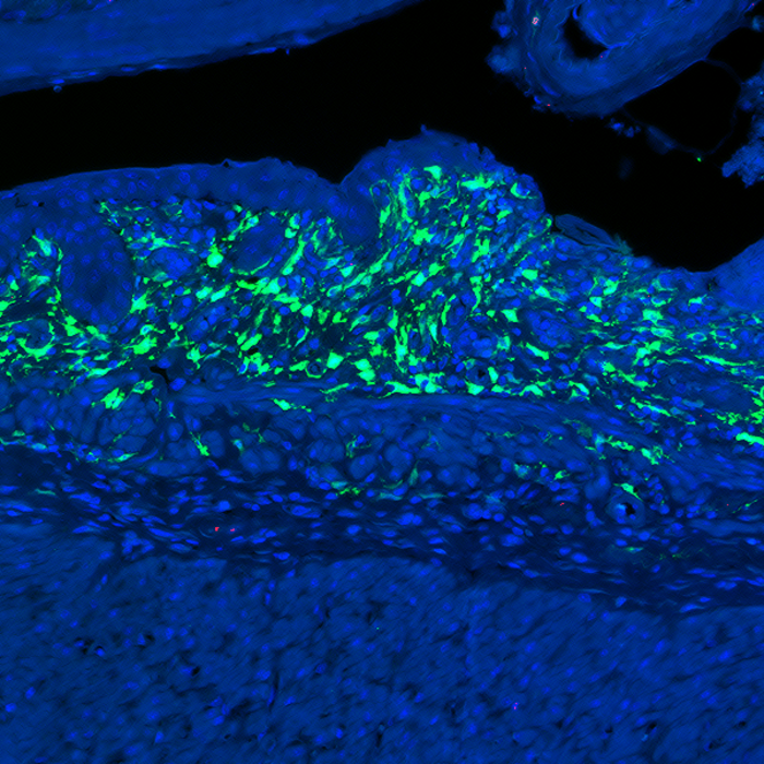 IL-11-producing fibroblasts appear in the damaged intestine