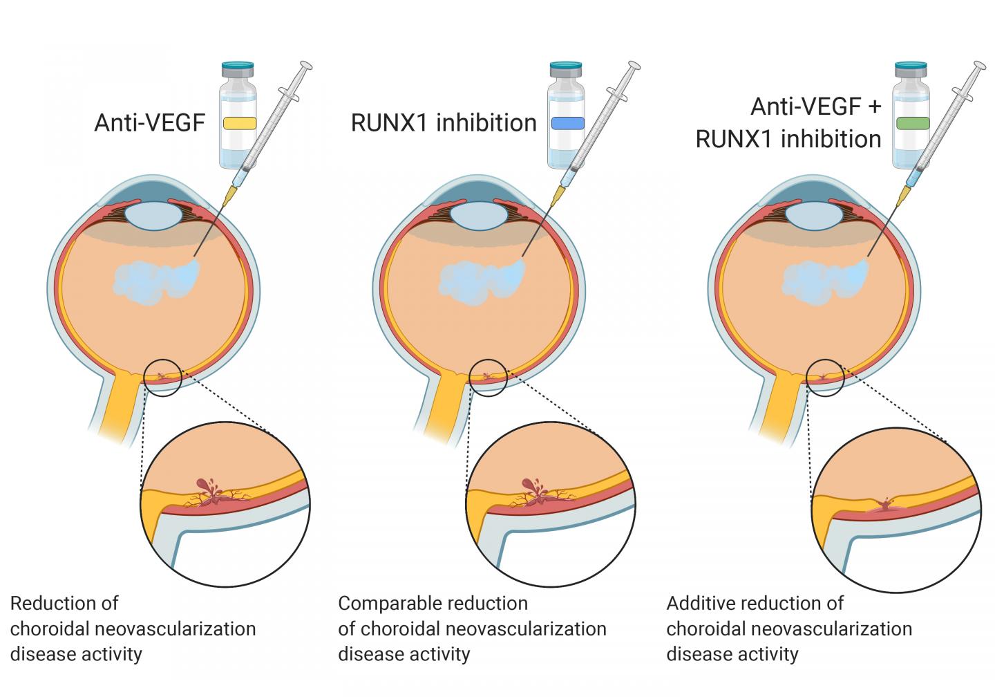 New therapeutic approach may help treat age-related macular degeneration effectively