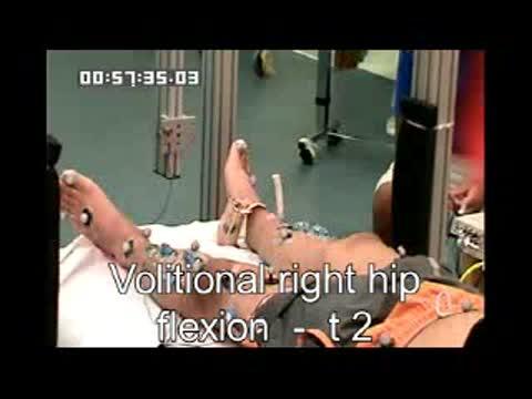 Motor recovery UofL - Supplemental Video S2