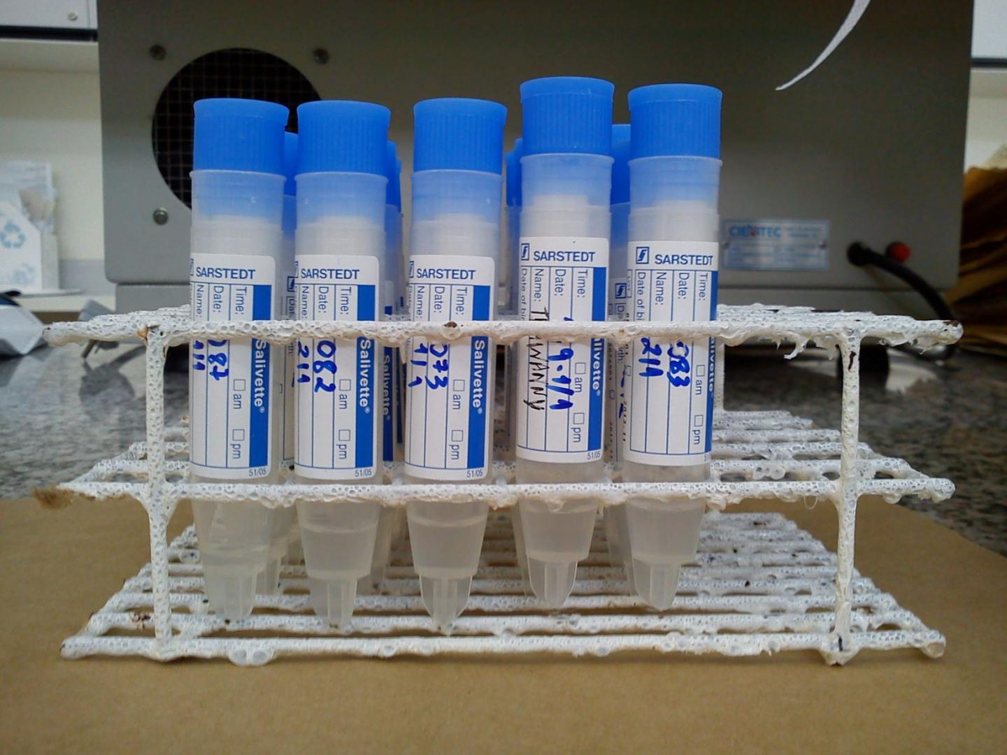 Uric Acid in Saliva