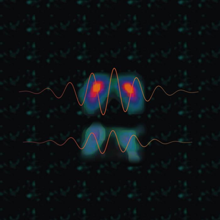 New Perspective on Tremor in Parkinson's Disease