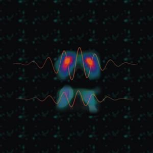 New Perspective on Tremor in Parkinson's Disease