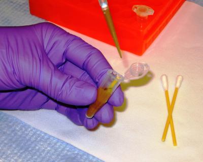 Extracting DNA from Complex Samples