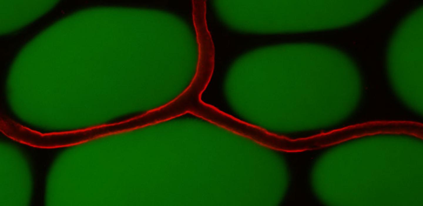 More Blood Vessels in Adipose Tissue May Alleviate Type 2 Diabetes