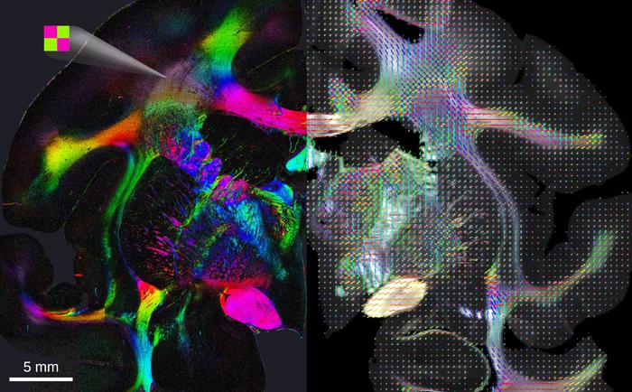 Color-coded nerve fibre orientations in a brain section obtained from scattered light imaging (SLI, left) and small-angle X-ray scattering (SAXS, right)