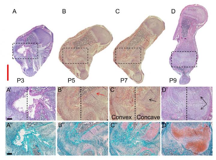 Asymmetric Callus Formation at the Fracture Site