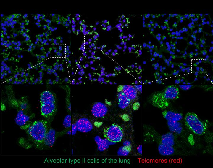 Representative Images of Lungs Treated with Gene Therapy Vectors