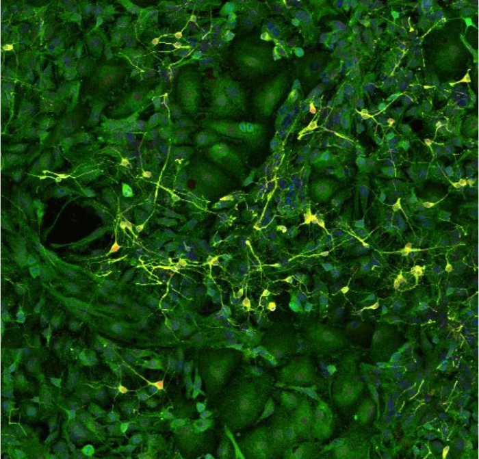 Neuronas del hipocampo y astrocitos