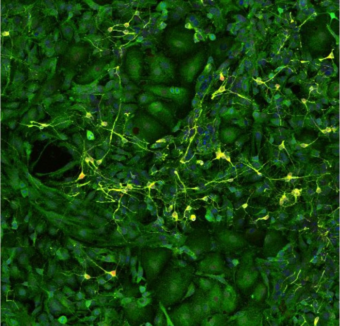 Hippocampal neurons and astrocytes