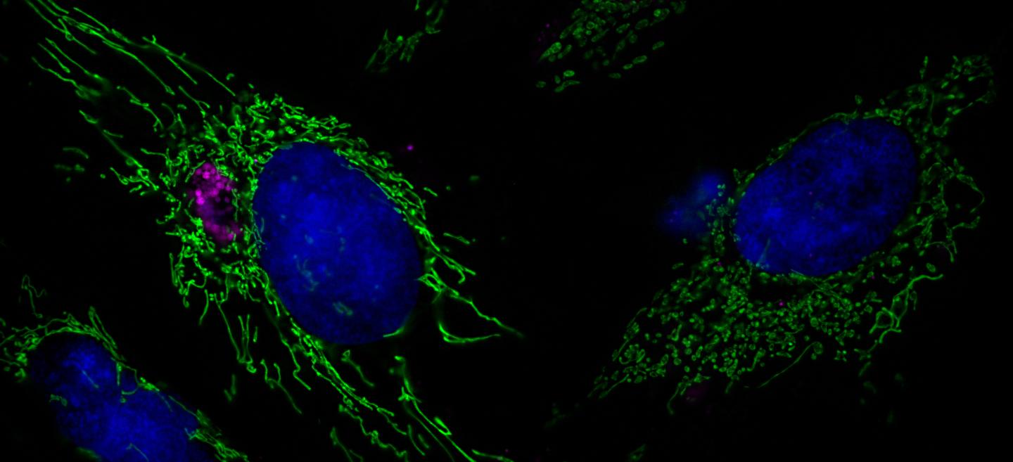 Primary HUVECS Expressing GFP Targeted to the Mitochondria