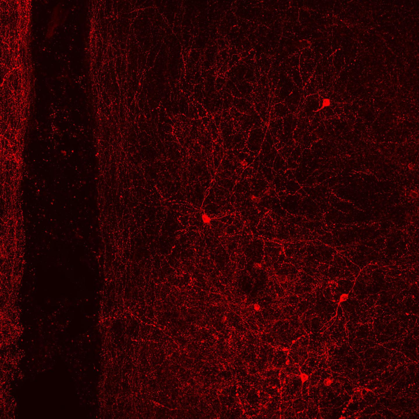 Neurons of Love