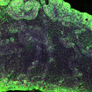 Choroid plexus