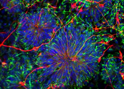 Embryonic Stem Cells that Have Differentiated into Neurons