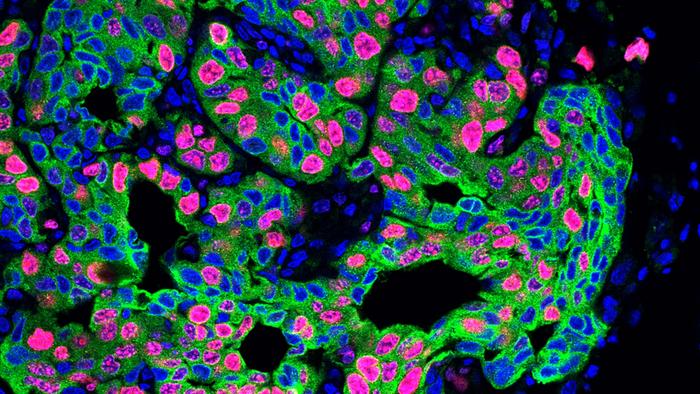 lung cancer metastasis in a mouse