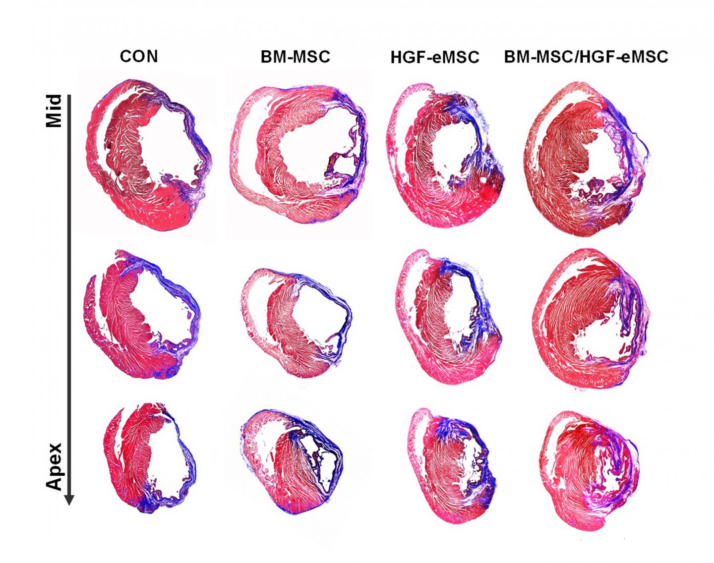 Comparison of Cardiac Tissues of Hearts Treated with Primed and Unprimed Cells