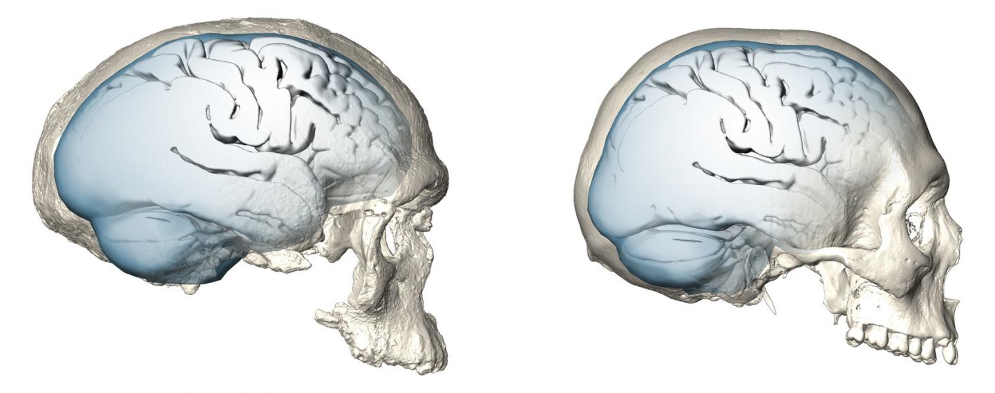 Brain Shape Evolution in <i>Homo sapiens</i>