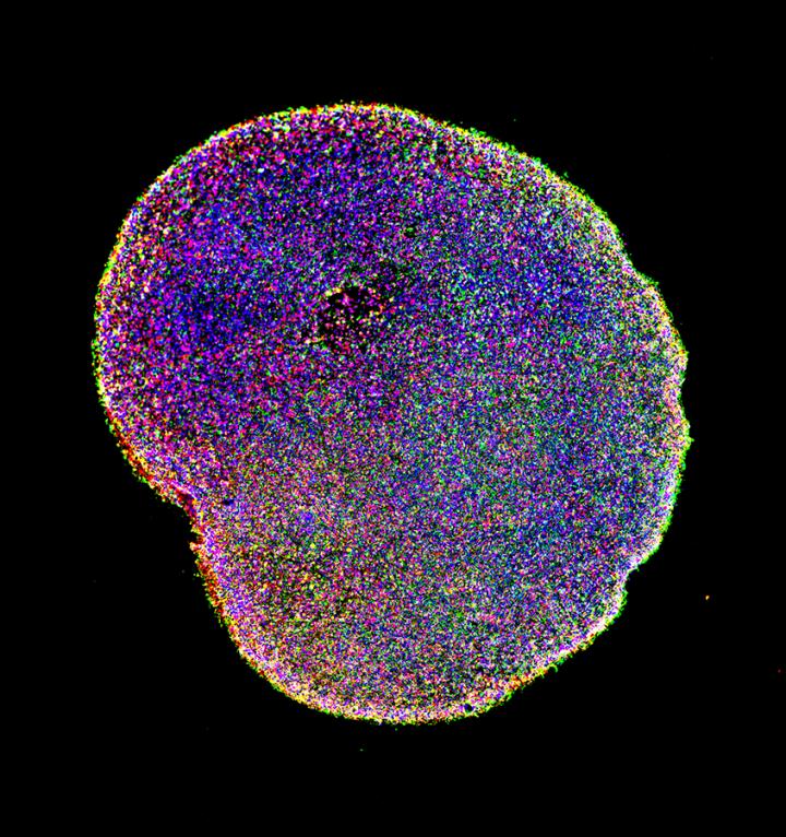 Brain Organoid at Six Months