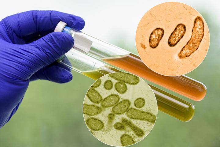 A Deep Dive into Microbes (1 of 2)