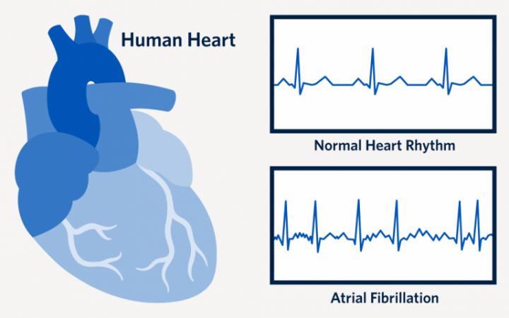 Matters of the Heart