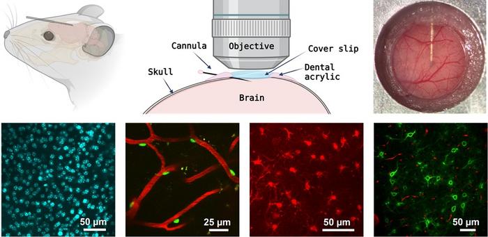 The newly developed cannula system delivers imaging agents directly to the brain without obstructing the optical path for high-resolution deep tissue imaging.