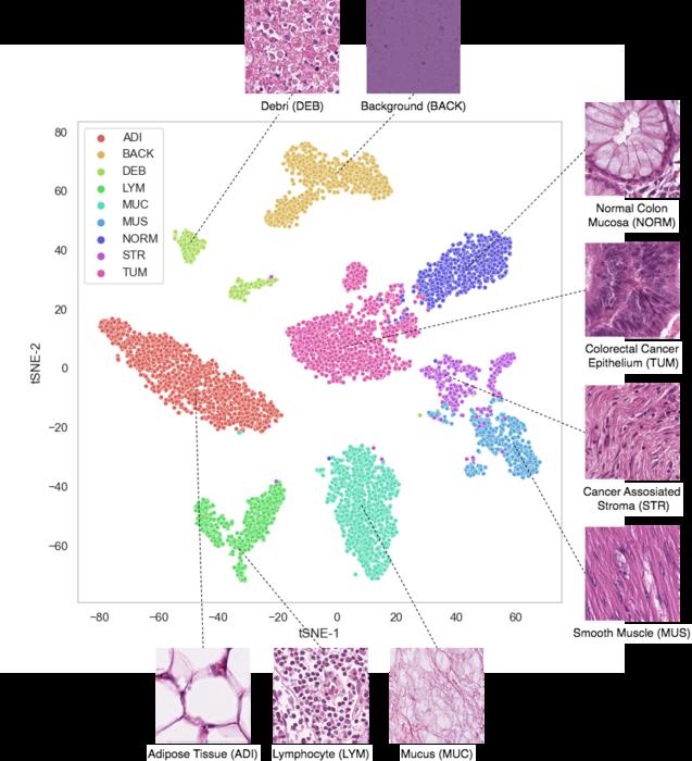 Each dot represents an image piece from a cancer microscope slide.