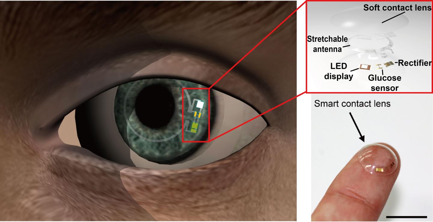 'Smart' Contact Lenses Monitor Glucose Levels in Tears
