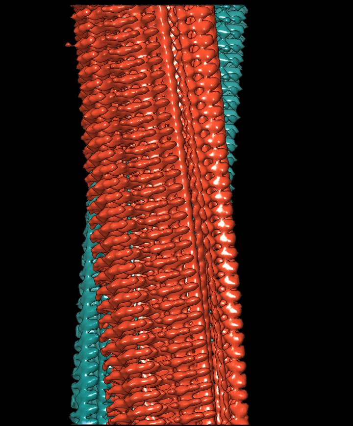 3-D Reconstruction of An Amyloid Fibril